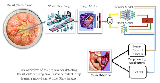 Breast Cancer Diagnosis